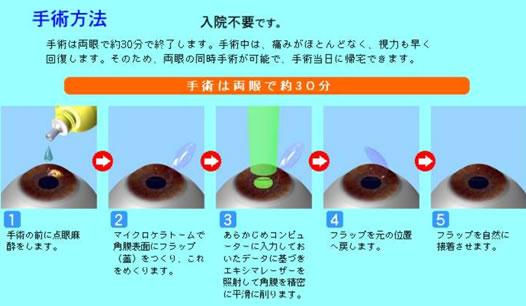 手術方法